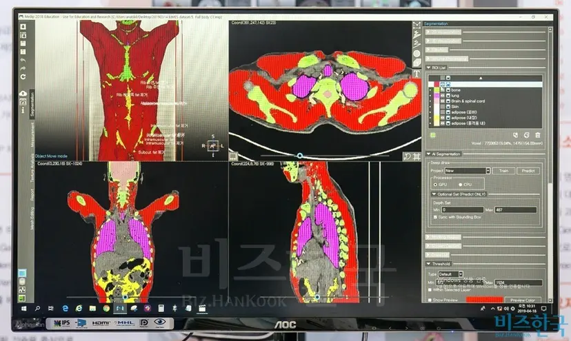 제약‧바이오 기업은 인공지능(AI)을 적극적으로 활용한다. 환자들이 이제는 질병을 진단하고 치료하는 걸 넘어서서 질병을 예측해 예방하기를 원하기 때문이다. 메디컬아이피의 3D 바이오 시뮬레이터 제품 ‘메딥’. 사진=최준필 기자