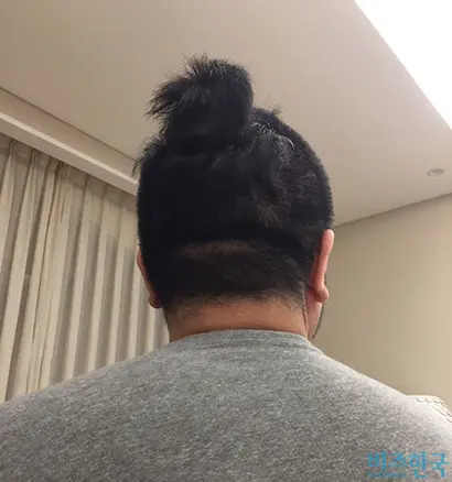 코로나19 감염 확산으로 미용실이 셧다운 되었지만 짧게 자른 머리로 버틸 수 있게 됐다. 사진=김면중 제공