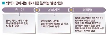 외벽이 굳어지는 메커니즘(담적병 발생기전). 사진=최서형 제공